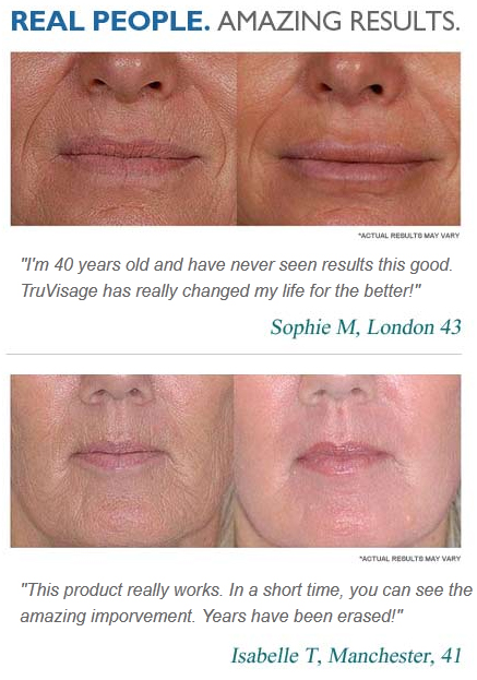 Anti Aging Cream Stretch Marks
